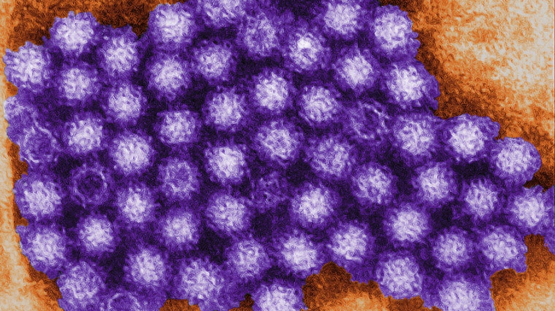 Norovirus: How to deal with the stomach bug as cases rise across Canada