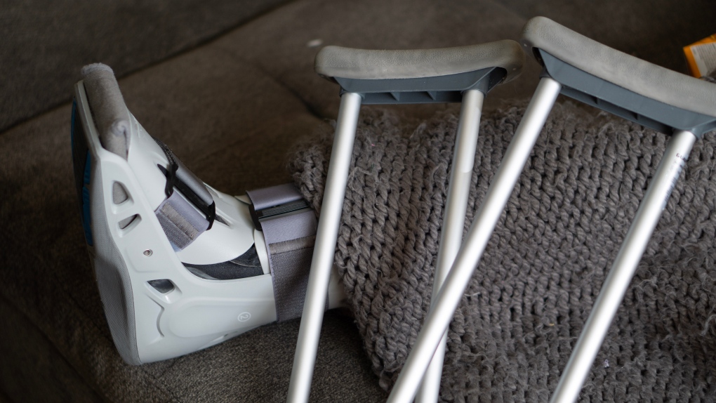 Canadian hospitals running out of crutches due to supply chain issues | CTV  News