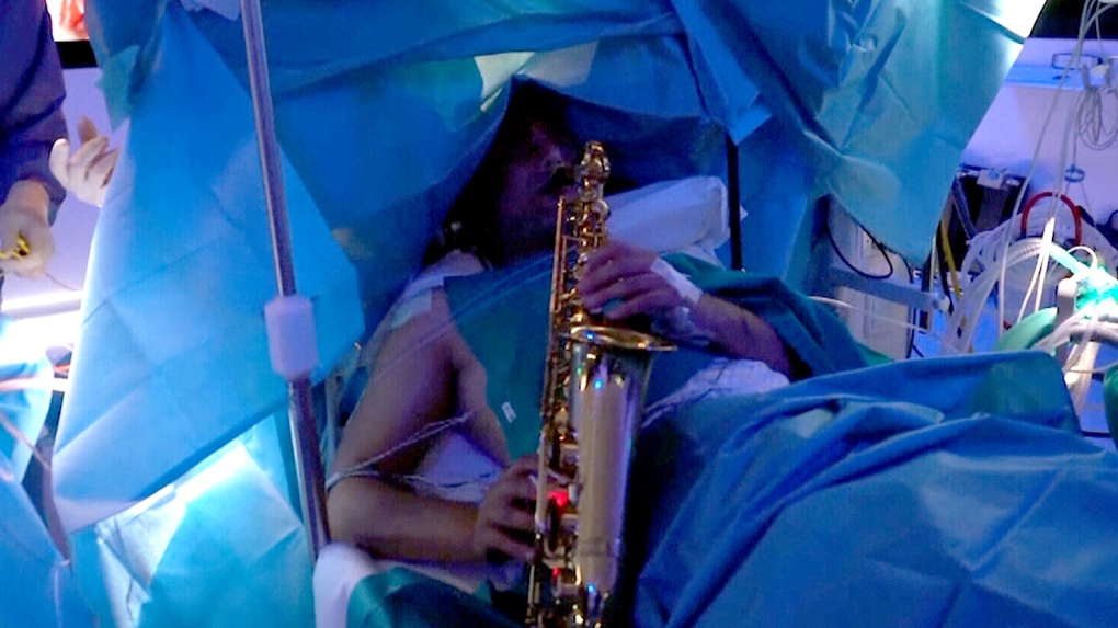 Patient Plays Saxophone During Brain Surgery 