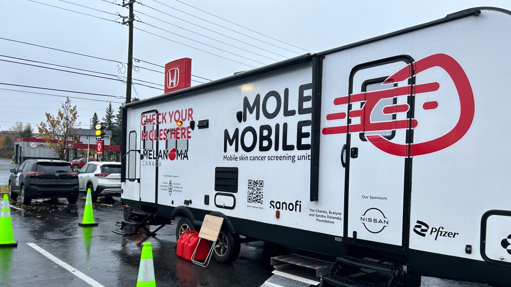 Sudbury: Mobile Ont. skin cancer clinic checking moles | CTV News