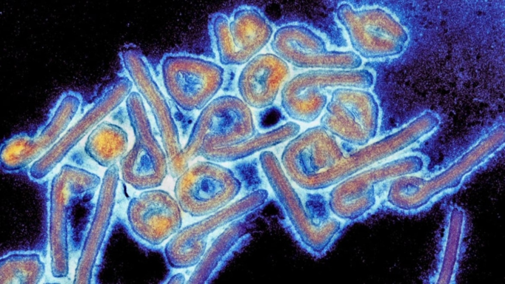 Equatorial Guinea confirms 8 new cases of Marburg virus | CTV News