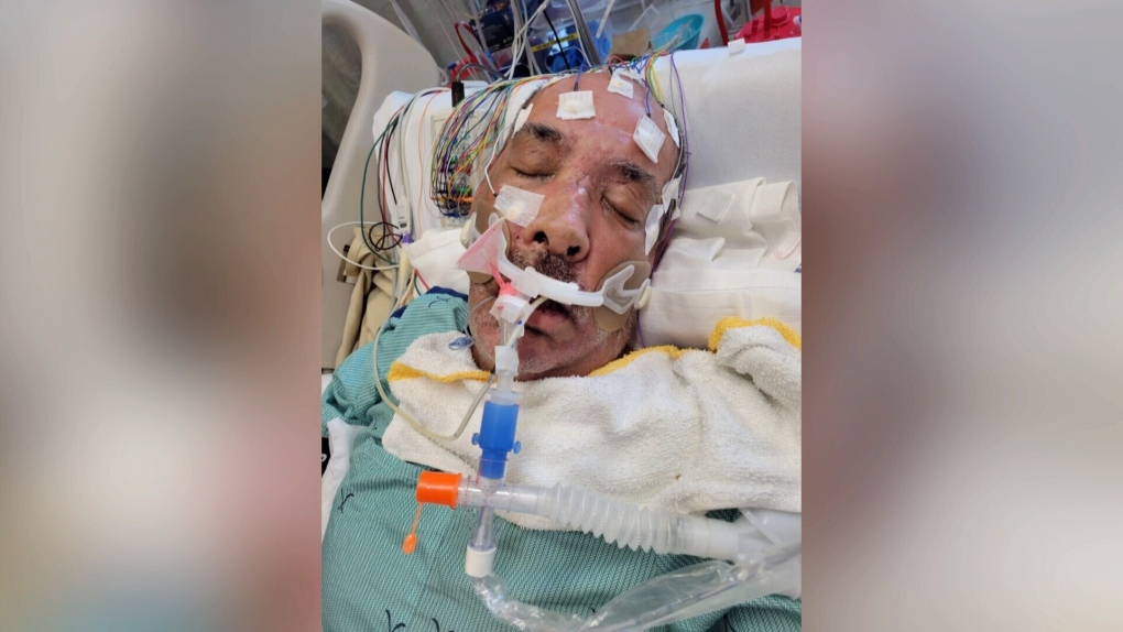 ‘They’ve changed his path of life’: Family looking for answers after Winnipeg man left in coma