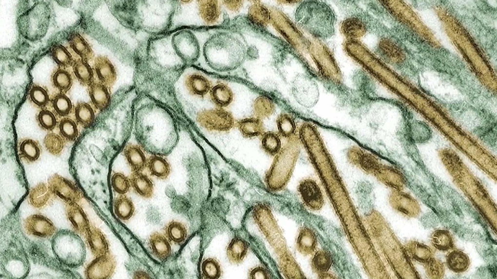 Testing confirms B.C. teen infected with Canada's first human case of avian flu