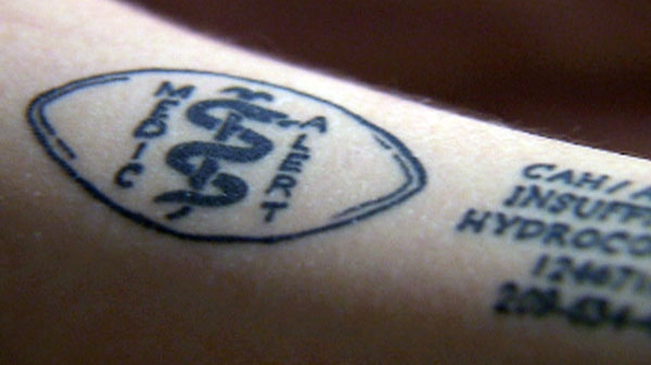 Some choose medical tattoos over bracelets | CTV News