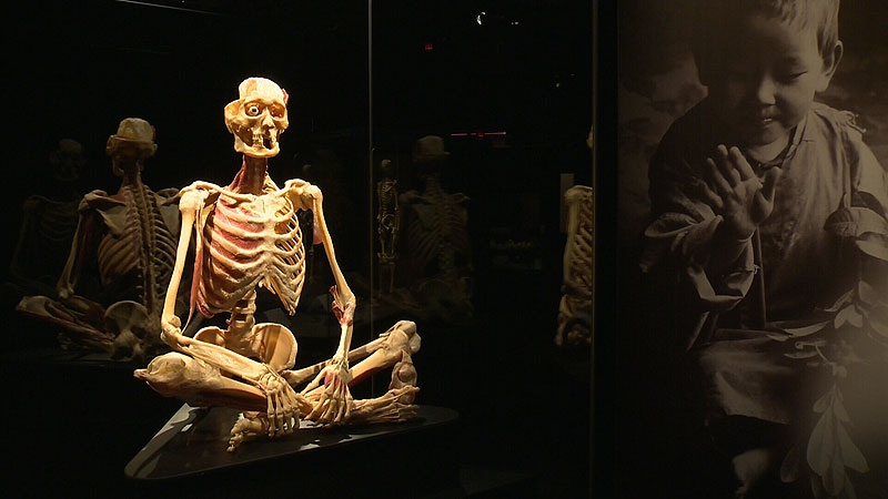 New Body Worlds exhibit shows cycle of life, using real, preserved human  bodies | CTV News