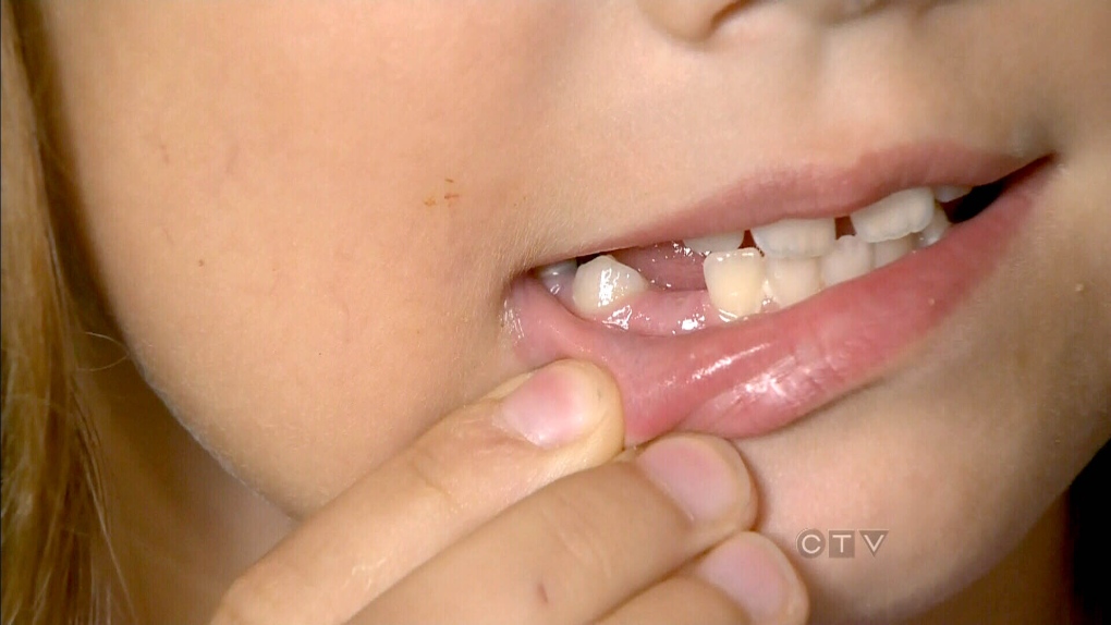 Tooth fairy pays more in Atlantic Canada