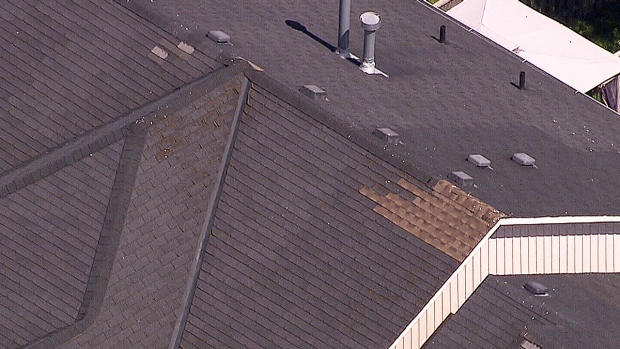 Consumer Alert How Long Should Shingles Last CTV News   Image 