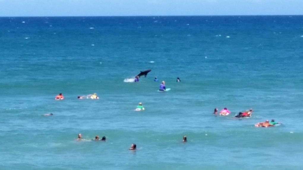Surfer killed after both legs torn off in Australia shark attack | CTV News
