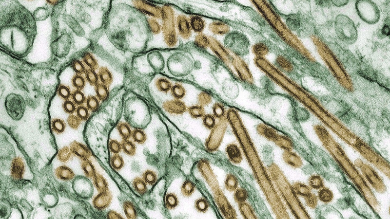 A colourized transmission electron micrograph of Avian influenza A H5N1 viruses (seen in gold) grown in MDCK cells (seen in green). (CDC / Cynthia Goldsmith, Jackie Katz, Sharif Zaki)