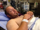 Ladislav Cumpelik suffered a broken arm, cracked ribs, and road rash. (CTV Vancouver Island)
