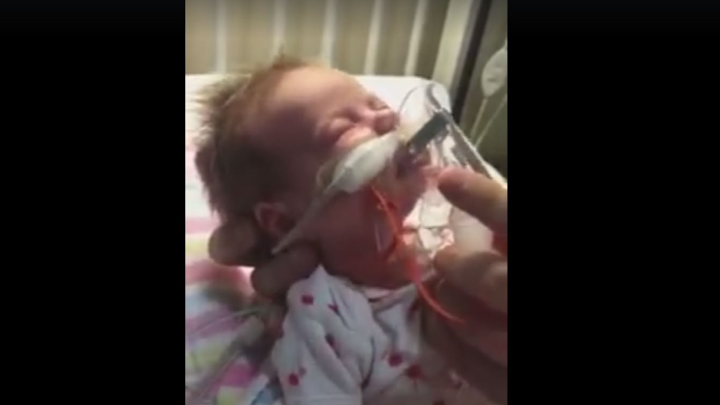 Australian mom's video of baby with whooping cough encourages vaccinations  | CTV News