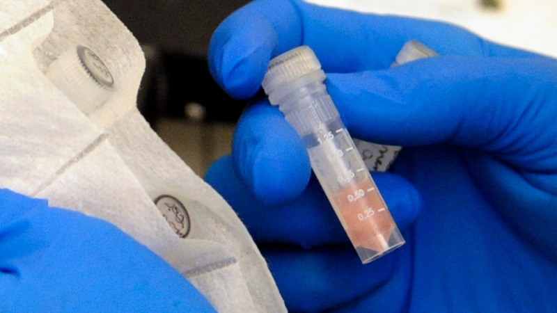 Laboratory technician packages cerebrospinal fluid. Current meningitis tests can take days to process while the infection could be fatal within hours.(AP Photo/Hannah Foslien)