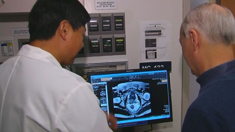 Dr. Robert Nam (left) has started a study to find out which prostate cancer screening method is best (CTV)