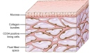 Fluid-filled spaces supported by a network of collagen bundles are shown in this image (llustration by Jill Gregory/ Mount Sinai Health System)
