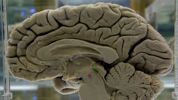 Study Offers New Look At Why Our Brains Evolved To Be So Big | CTV News