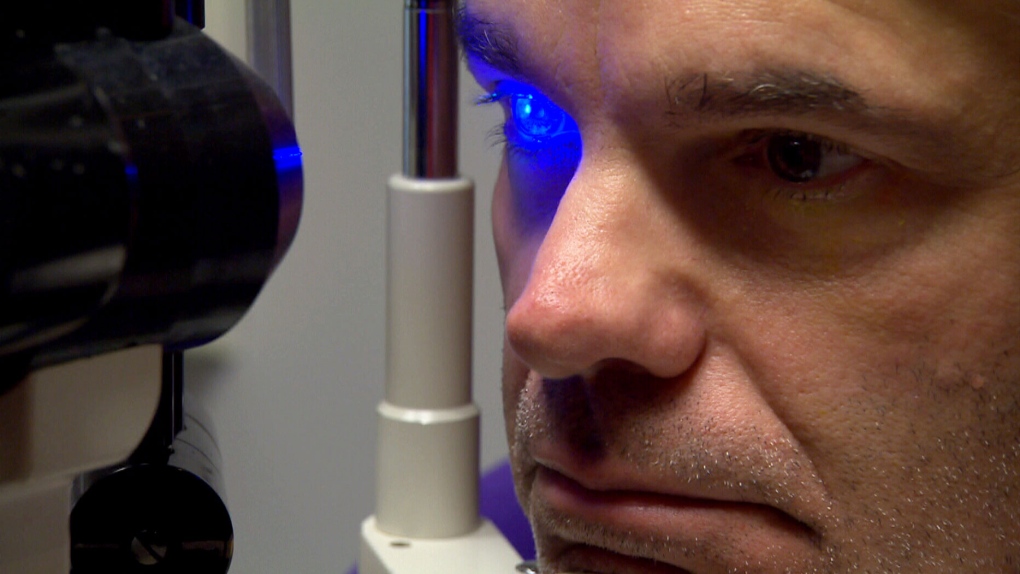 W5 investigates a rare but painful side effect of laser eye surgery