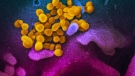 Intelligence shared among Five Eyes nations indicates it is 'highly unlikely' that the coronavirus outbreak was spread as a result of an an accident in a laboratory but rather originated in a Chinese market, according to two Western officials citing an intelligence report. (NIAID-RML / CNN)