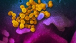 Intelligence shared among Five Eyes nations indicates it is 'highly unlikely' that the coronavirus outbreak was spread as a result of an an accident in a laboratory but rather originated in a Chinese market, according to two Western officials citing an intelligence report. (NIAID-RML / CNN)