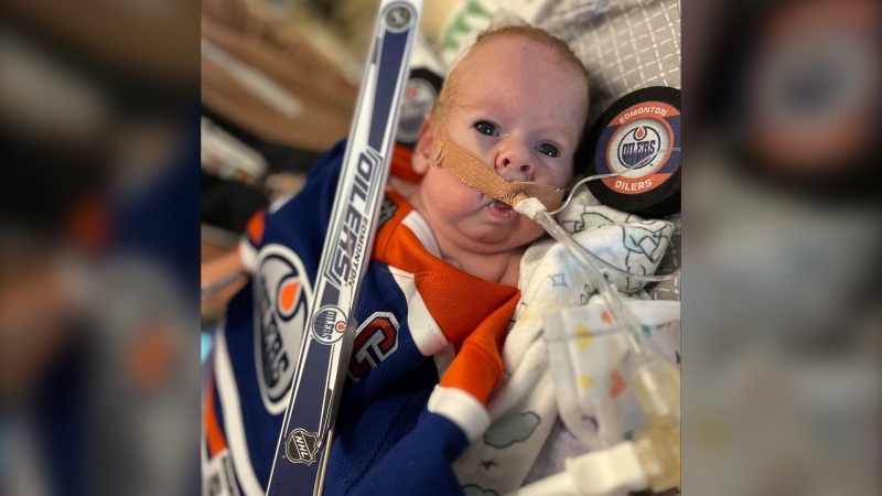 At 2 kilograms, baby Mark Binner could be Canada's smallest Oilers fan. (Carla Shynkaruk / CTV News)