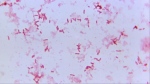 Plague is caused by the bacterium Yersinia pestis. (CDC via CNN Newsource)