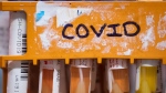 Doctors say we are in a summer wave of COVID-19. Specimens to be tested for COVID-19 are seen in Surrey, B.C., on Thursday, March 26, 2020. THE CANADIAN PRESS/Darryl Dyck