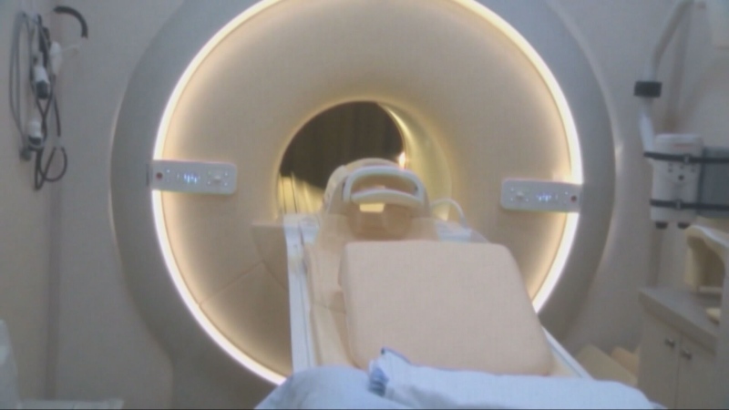 MRI