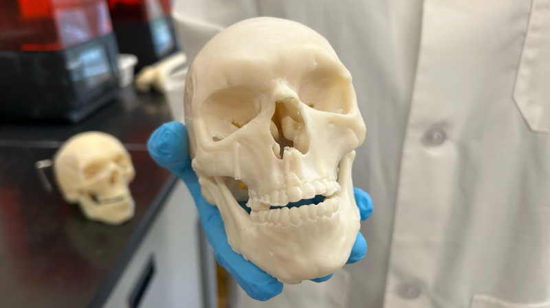 A 3D-printed skull, made with synthetic materials, at the University of Waterloo. (Krista Sharpe/CTV News)