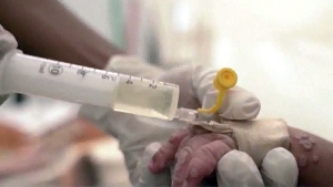 WHO approves first-of-its-kind mpox test