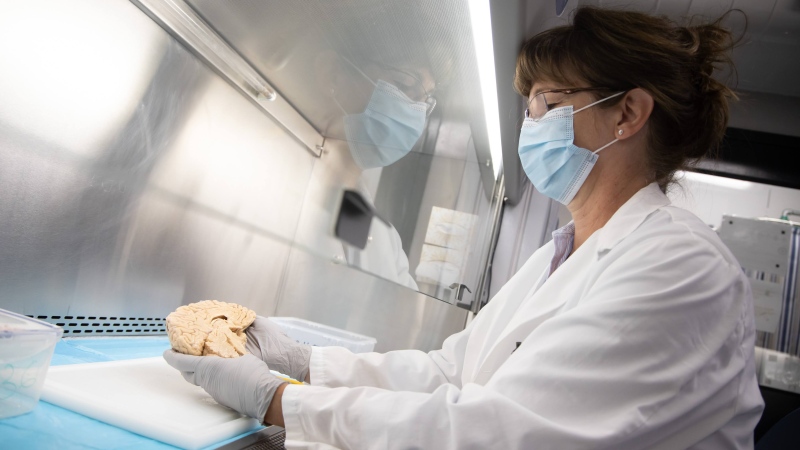 The brain bank at the Douglas Research Centre. (Owen Egan)