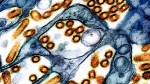 This colorized electron microscope image provided by the National Institute of Allergy and Infectious Diseases in 2024 shows avian influenza A virus (bird flu) particles, red/yellow, grown in cultured cells. (CDC, NIAID via AP)