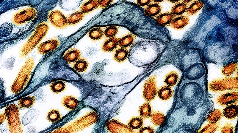 This colorized electron microscope image provided by the National Institute of Allergy and Infectious Diseases in 2024 shows avian influenza A virus (bird flu) particles, red/yellow, grown in cultured cells. (CDC, NIAID via AP) 