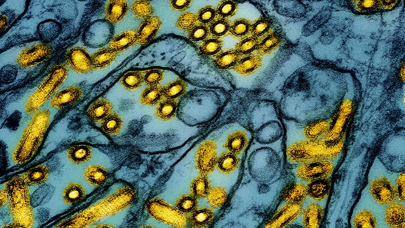 A genetic analysis of samples of the bird flu virus from a Louisiana patient show the virus likely mutated in the patient to potentially become more transmissible to humans. (CDC / NIAID / AP via CNN Newsource) 